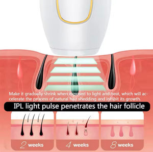 IPL Laser Hair Removal – جهاز إزالة الشعر بالليزر IPL