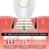 IPL Laser Hair Removal – جهاز إزالة الشعر بالليزر IPL