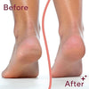 Callus Remover – مزيل الجلد الميت