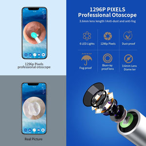 Smart Ear Cleaning Device - لاسلكي واي فاي خلال أذني منظار الأذن كاميرا Borescope مضيئة شمع الأذن تنظيف الأسنان فحص الفم الرعاية الصحية الأذن الأنظف